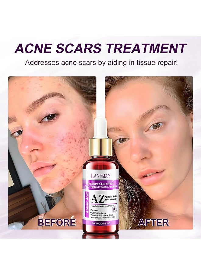 LANEMAY 10% Nonyl Decanoate Skin Rejuvenation Essence for Tightening Pores and Evening Skin Tone - Facial Care 30ml - Image 5